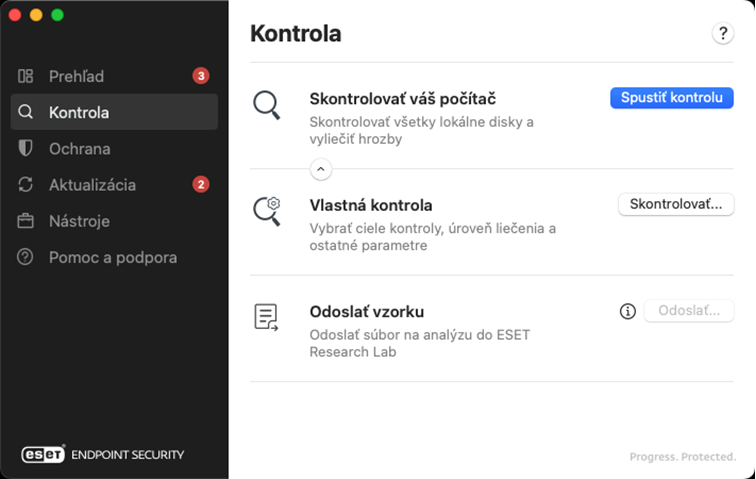 Možnosti kontroly v ESET Endpoint Security